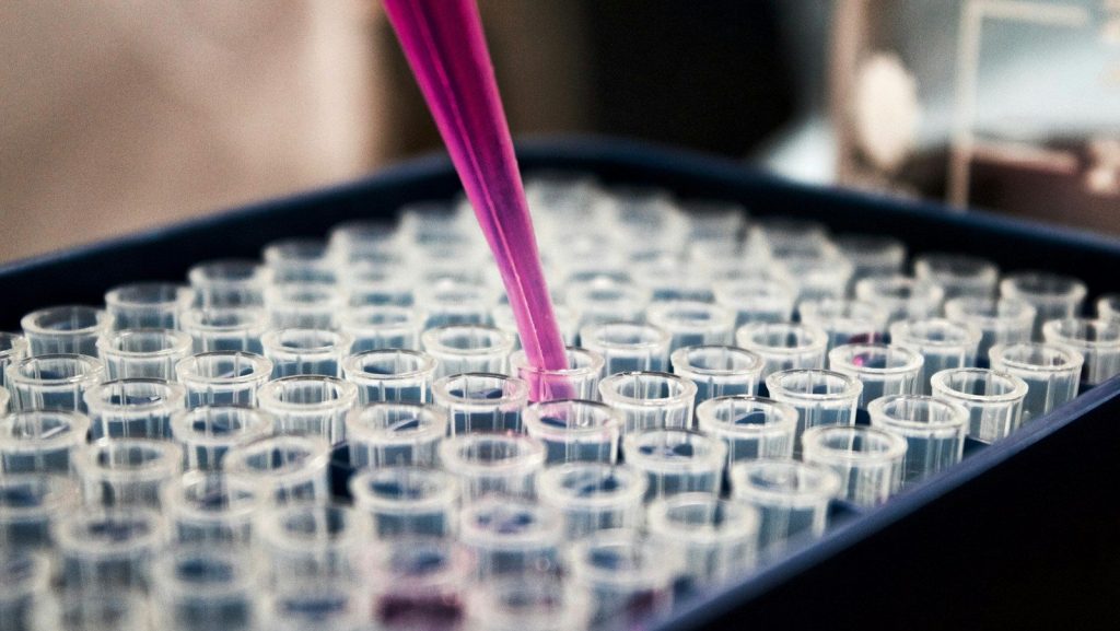 Could a Canadian breakthrough lead to an ALS cure?