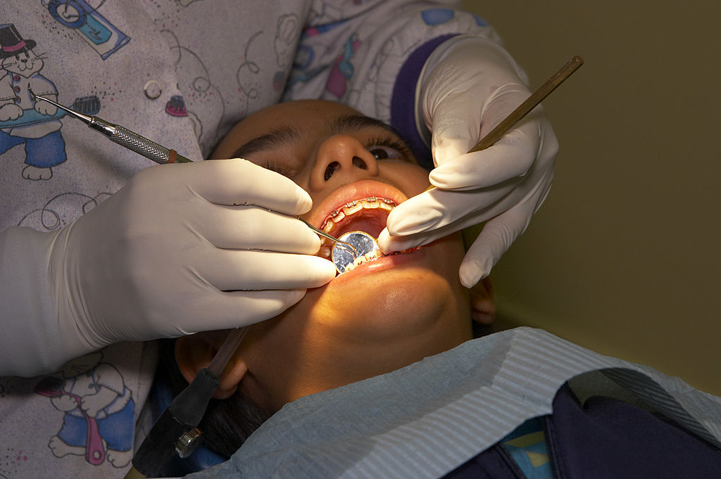 Liberals praise Canadian Dental Care Plan milestone, forewarn of Conservative cuts